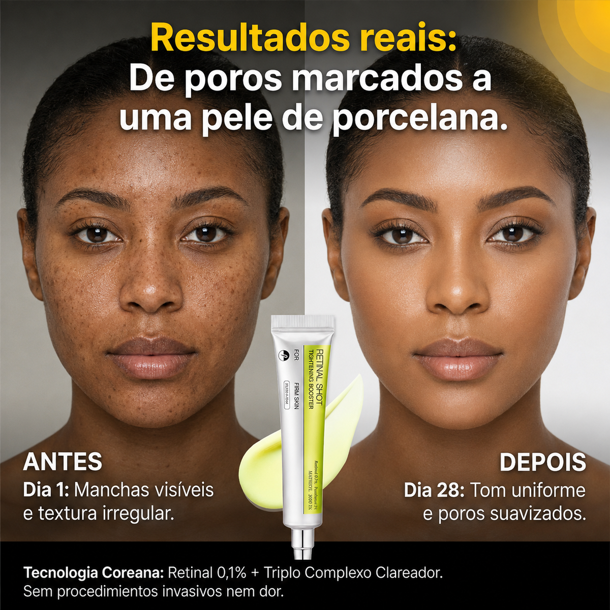 Climax™ - Sérum Coreano  para Manchas, Poros +60% DE DESCONTO SOMENTE HOJE! 🔥